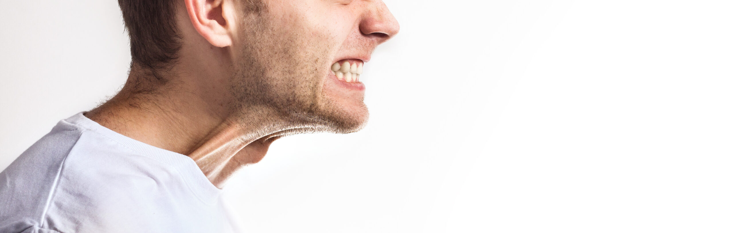 Bruxism or grinding clenching can cause a painful jaw & headaches