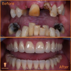 Super for urgent Dental treatment 